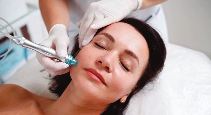 Procedimento estético regenerativo com produto Skinderma